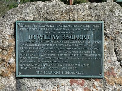 Dr. William Beaumont (and the gastric fistula)